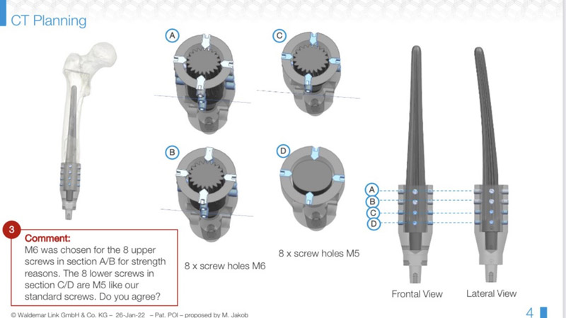 Pre-operative CT planning by LINK 