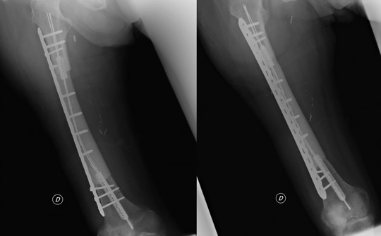 X-rays at 1 month