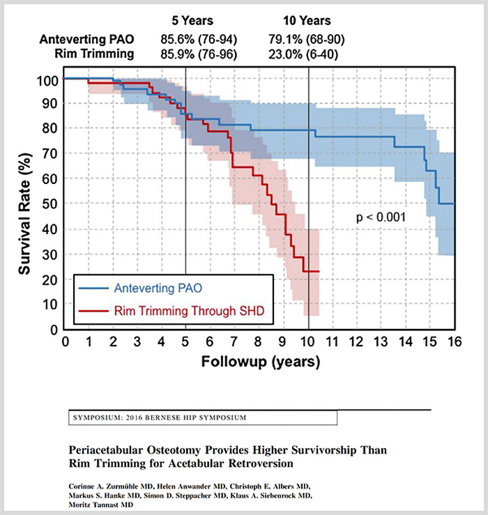 Anteverting/reverse PAO