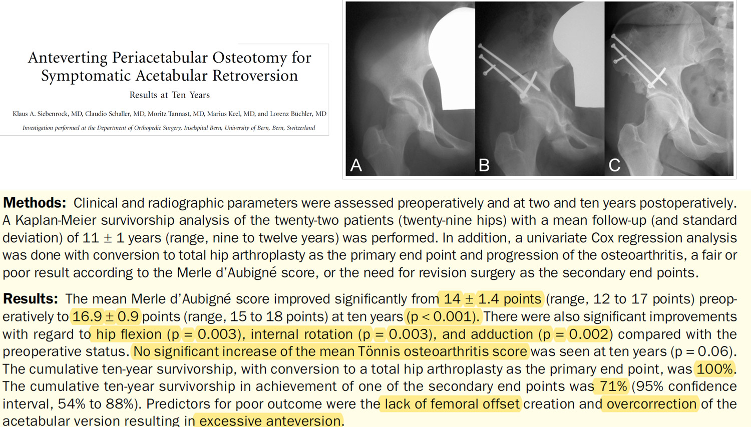 Anteverting Pariacetabular Osteotomy fo Symptomatic Acetabular Retroversion