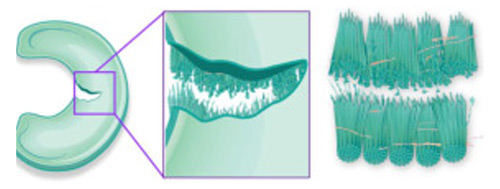 Radial tear: Failure of the circumferential fibers