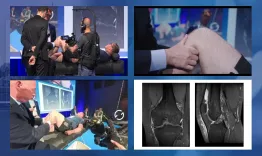 Live clinic - ACL, PCL, multilig, knee revision - Ligament injury