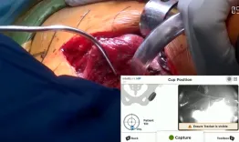 PCO Tour: Camilo Helito