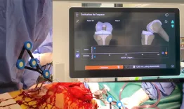 Revision of unicompartmental knee arthroplasty to total knee arthroplasty using a robotic system : a smart, efficient and conservative approach