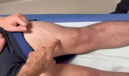 Arthrogenic Muscle Inhibition and Surgery Awareness, Detection and Treatment