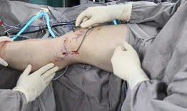 Virtual fellowship: All you need to know on new grafts for ACL with Camilo Helito