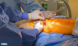 Knee Joint preservation in Japan: TCVO, inpatient rehab & surgical mastery 