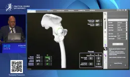 Revision THA through Direct Anterior Approach: exposure and component removal