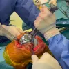 Uncemented total knee arthroplasty