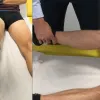 Lésion ligamentaire du genou - Examen physique