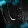 Management of an ACL graft failure done by Harmstrings