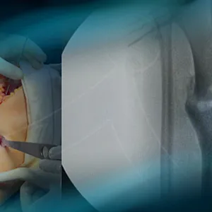 Post-traumatic knee pain: How to treat double varus deformity?