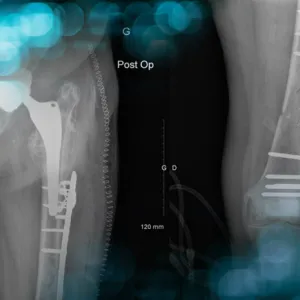 When everything goes wrong  Again and again